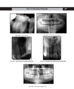 دانلود جزوه Dental and MaxillofacialRadiology فرنی آر کارجودکار 327 صفحه PDF 📘-1