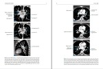 دانلود کتاب 220massimo silva mdct anatomy-body صفحه PDF 📘-1